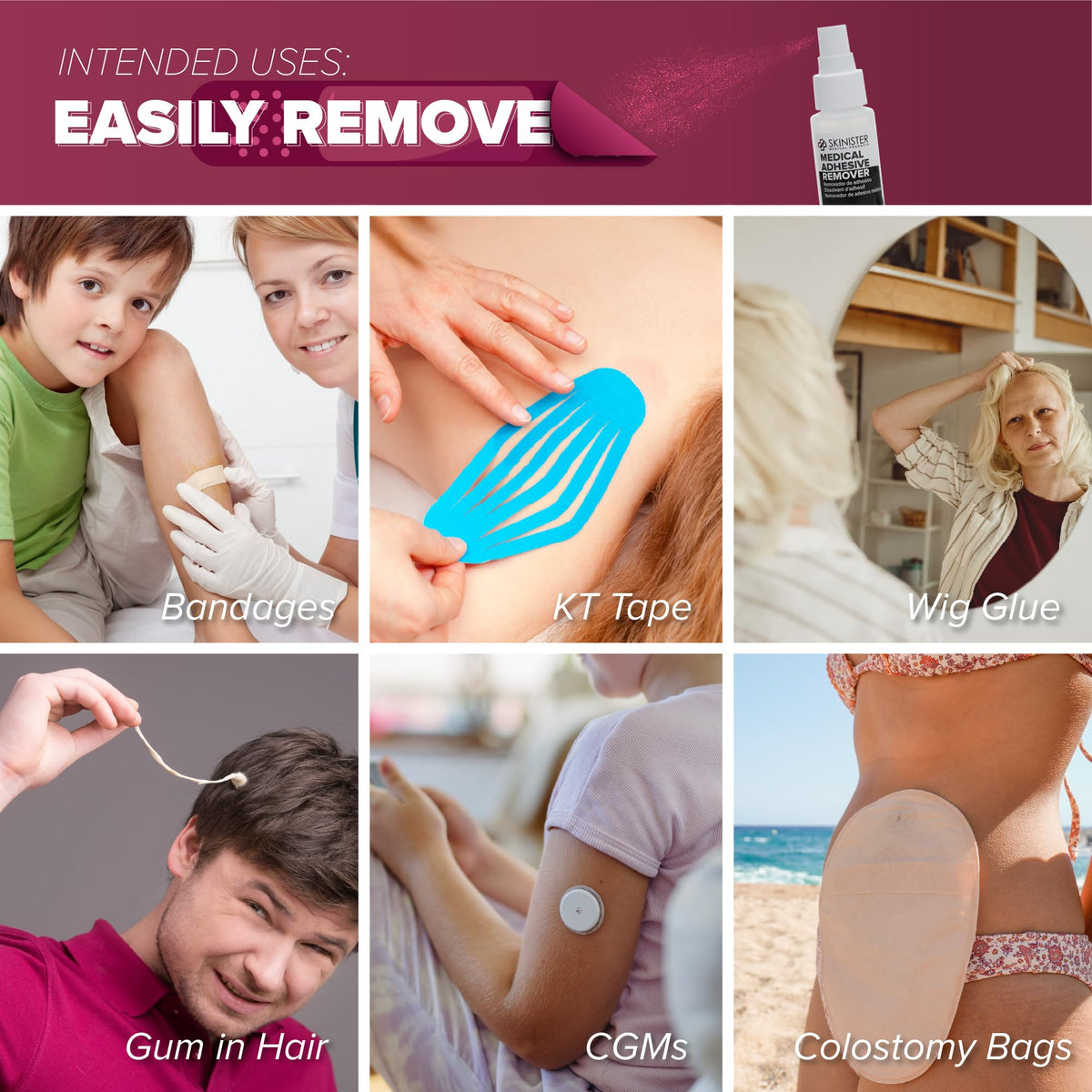 Adhesive Remover Wipes 50 Dry Wipes + 2oz Spray Solution C91319